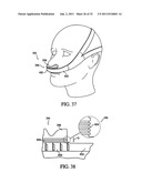 PATIENT INTERFACE DEVICE diagram and image