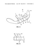 PATIENT INTERFACE DEVICE diagram and image