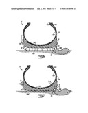 TIRE HAVING SIDEWALL PROTECTION diagram and image