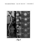 METHOD FOR DETERMING A CORRECTION FUNCTION FOR CORRECTING COMPUTED     TOMOGRAPHIC NUMBERS OF A SMALL TARGET OBJECT IN A CT IMAGE diagram and image