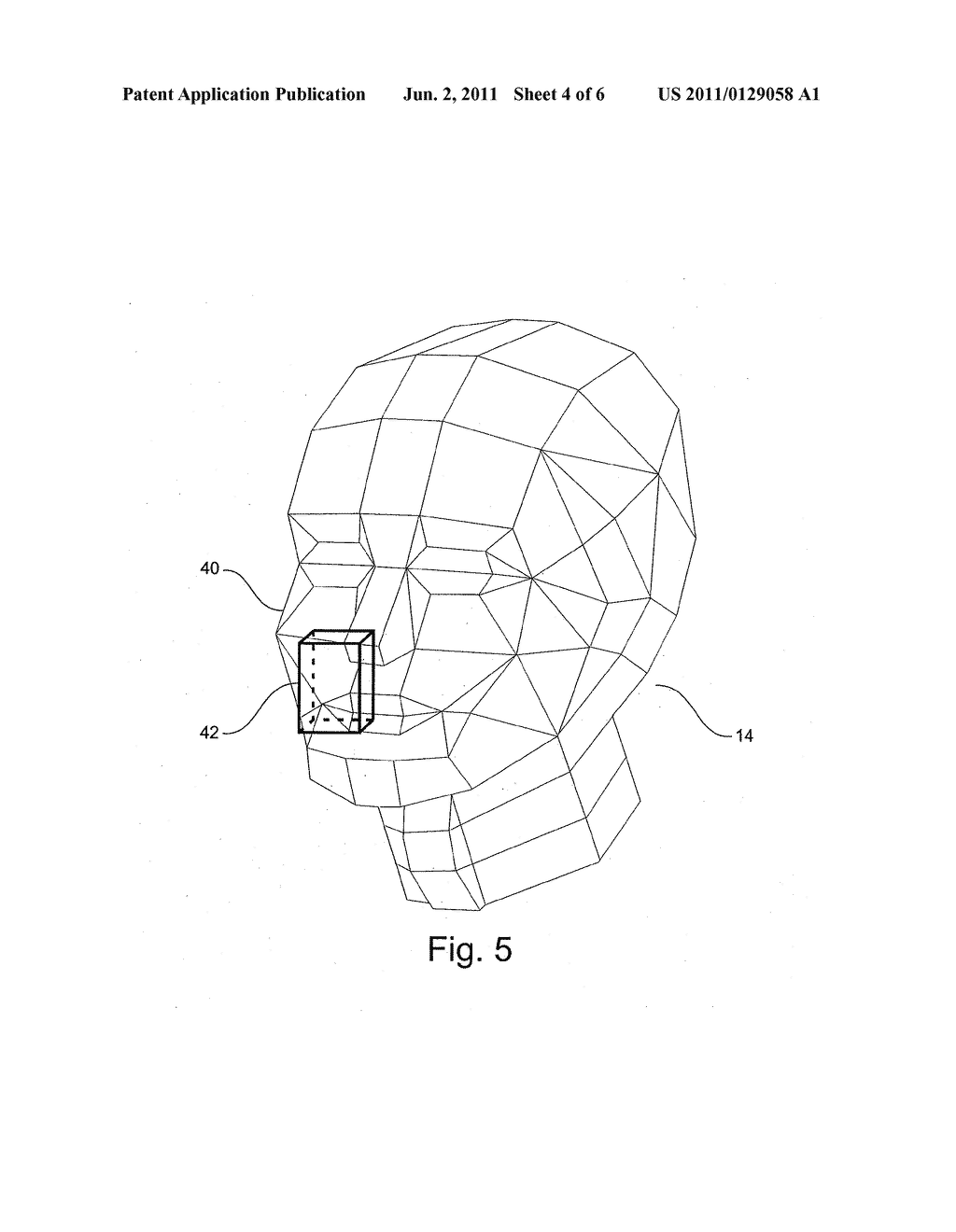 METHOD FOR PRODUCING A DENTAL 3D X-RAY IMAGE, AND X-RAY DEVICE THEREFOR - diagram, schematic, and image 05