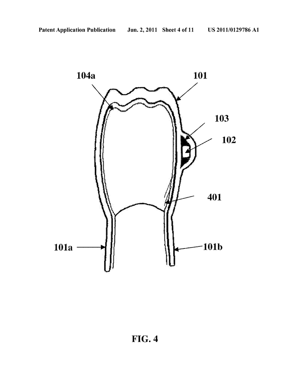 Removable Orthodontic Appliance - diagram, schematic, and image 05