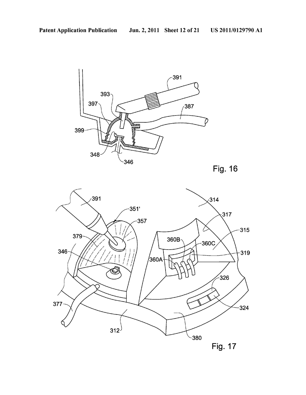 DENTAL RESTORATION CONDITIONING APPARATUS AND METHOD - diagram, schematic, and image 13