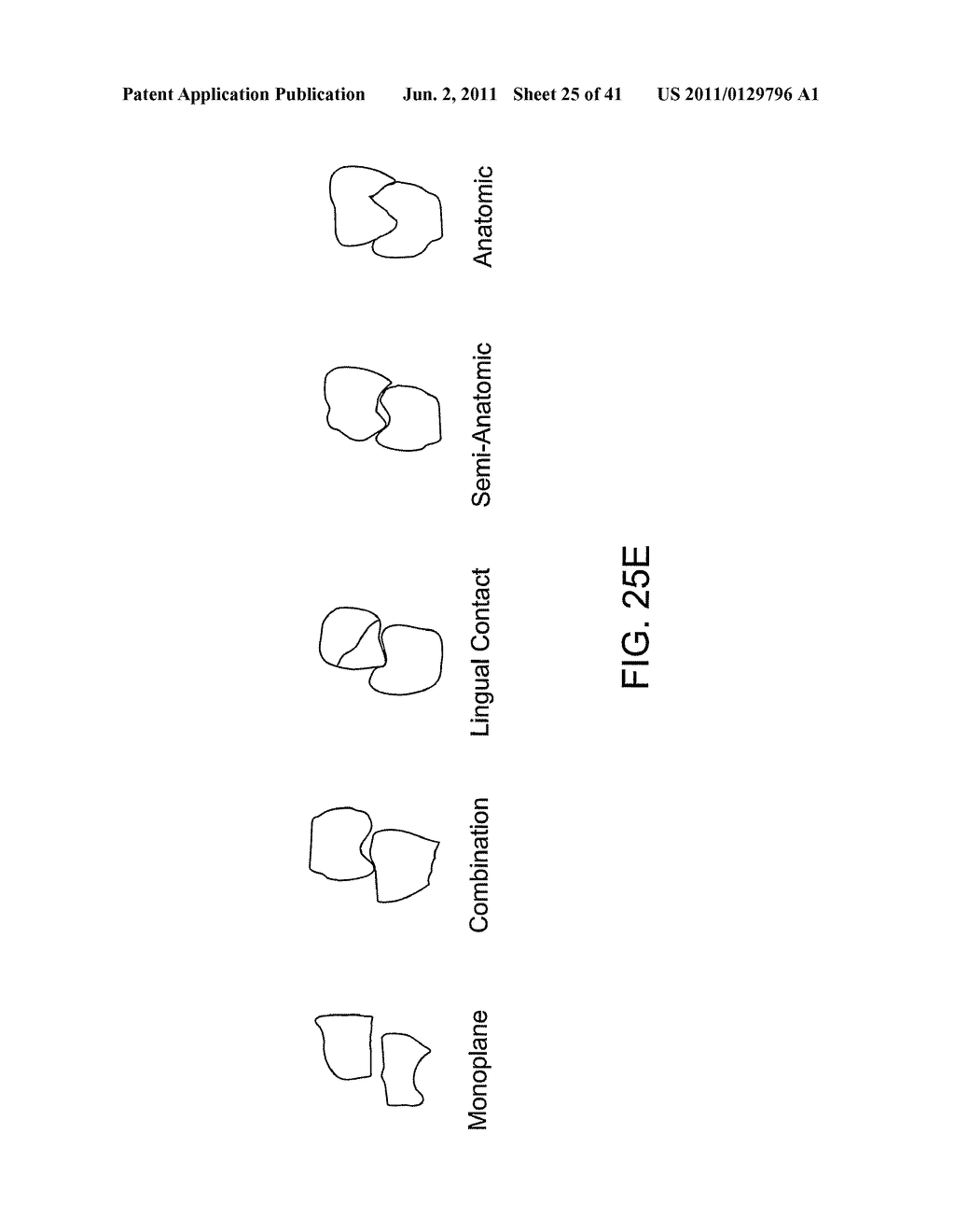 DENTURES, DENTAL ARCHES AND METHODS OF MANUFACTURE - diagram, schematic, and image 26