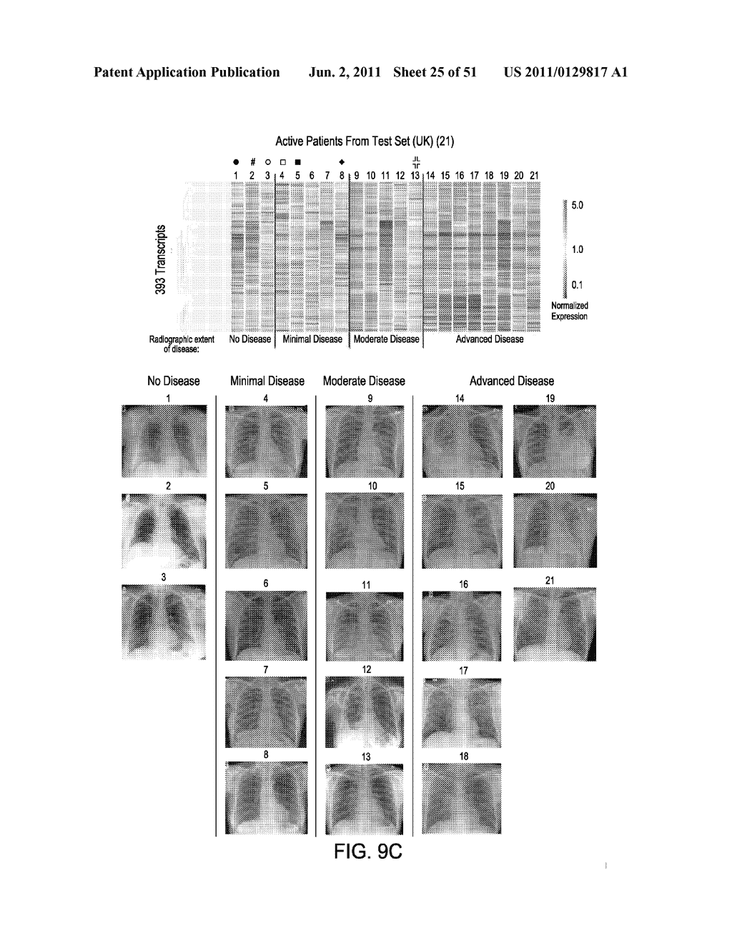 BLOOD TRANSCRIPTIONAL SIGNATURE OF ACTIVE VERSUS LATENT MYCOBACTERIUM     TUBERCULOSIS INFECTION - diagram, schematic, and image 26