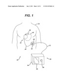 Non-Invasive Measurement of Fluid Pressure In An Adjustable Gastric Band diagram and image