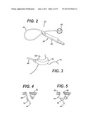 Non-Invasive Measurement of Fluid Pressure In An Adjustable Gastric Band diagram and image