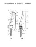 PATIENT-MOUNTED RETRACTION diagram and image