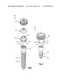 PATIENT-MOUNTED RETRACTION diagram and image