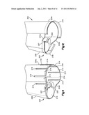 PATIENT-MOUNTED RETRACTION diagram and image