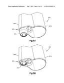 PATIENT-MOUNTED RETRACTION diagram and image