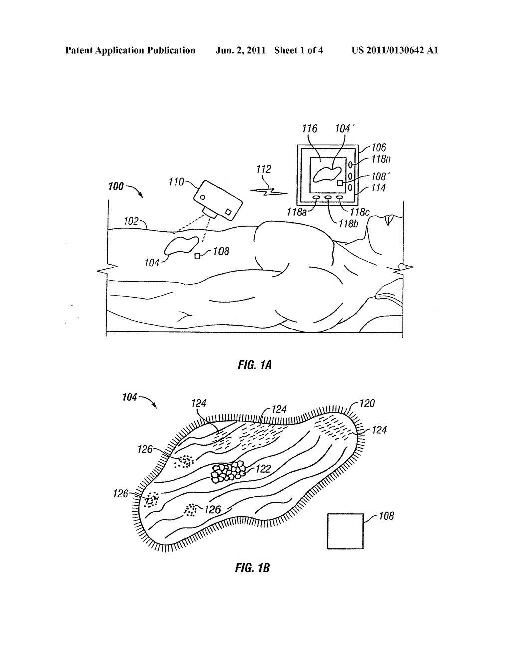 SYSTEM AND METHOD FOR TRACKING HEALING PROGRESS OF TISSUE - diagram, schematic, and image 02