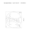 Intraoperative C-arm fluoroscope datafusion system diagram and image