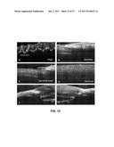 APPARATUS FOR BIOMEDICAL IMAGING diagram and image