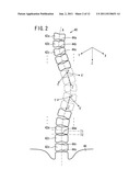 VERTEBRA SEGMENTATION APPARATUS, VERTEBRA SEGMENTATION METHOD, AND     RECORDING MEDIUM WITH PROGRAM FOR VERTEBRA SEGMENTATION diagram and image