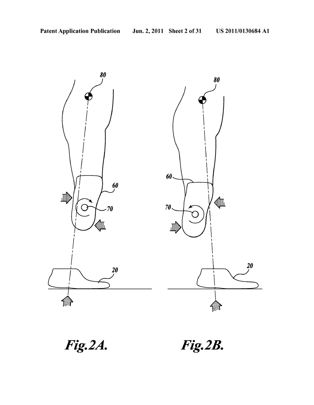 LOWER-LIMB PROSTHESIS FORCE AND MOMENT TRANSDUCER - diagram, schematic, and image 03