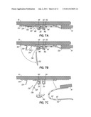 Restraint Device And Method Of Use diagram and image