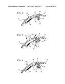 VASCULAR ACCESS DEVICE TIME SENSITIVE STATUS INDICATION diagram and image