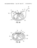 APPARATUS AND METHODS FOR TREATMENT OF HEMORRHAGING diagram and image