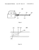 Contact free and perforation safe endoluminal laser treatment device and     method diagram and image