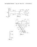 Method for Less Invasive Knee Resection diagram and image