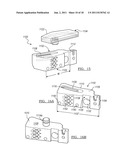 Method for Less Invasive Knee Resection diagram and image