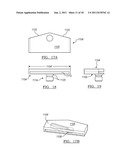 Method for Less Invasive Knee Resection diagram and image