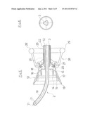 UTERUS MANIPULATOR diagram and image