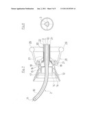 UTERUS MANIPULATOR diagram and image