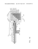 Device For Deploying A Fastener For Use In A Gastric Volume Reduction     Prodecure diagram and image