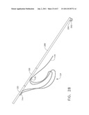 Device For Deploying A Fastener For Use In A Gastric Volume Reduction     Prodecure diagram and image