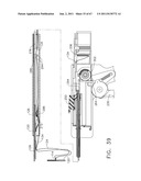 Device For Deploying A Fastener For Use In A Gastric Volume Reduction     Prodecure diagram and image