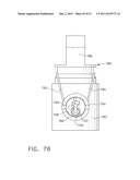 Device For Deploying A Fastener For Use In A Gastric Volume Reduction     Prodecure diagram and image