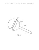 METHODS FOR CONTINUOUS SUTURE PASSING diagram and image