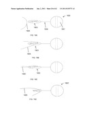 METHODS FOR CONTINUOUS SUTURE PASSING diagram and image