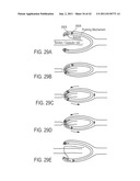 METHODS FOR CONTINUOUS SUTURE PASSING diagram and image