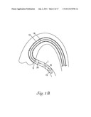 CATHETER WITH OCCLUDING CUFF diagram and image