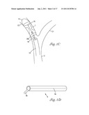 CATHETER WITH OCCLUDING CUFF diagram and image