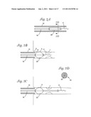 CATHETER WITH OCCLUDING CUFF diagram and image