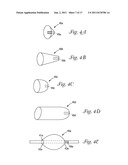 CATHETER WITH OCCLUDING CUFF diagram and image