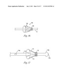 CATHETER WITH OCCLUDING CUFF diagram and image