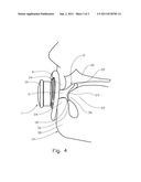 Pacifier diagram and image