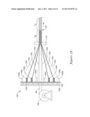 CORD FOR VERTEBRAL STABILIZATION SYSTEM diagram and image