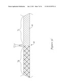 CORD FOR VERTEBRAL STABILIZATION SYSTEM diagram and image