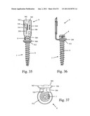 Method and apparatus for performing spinal surgery diagram and image