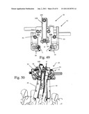 Method and apparatus for performing spinal surgery diagram and image