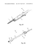 Method and apparatus for performing spinal surgery diagram and image