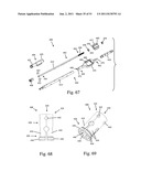 Method and apparatus for performing spinal surgery diagram and image