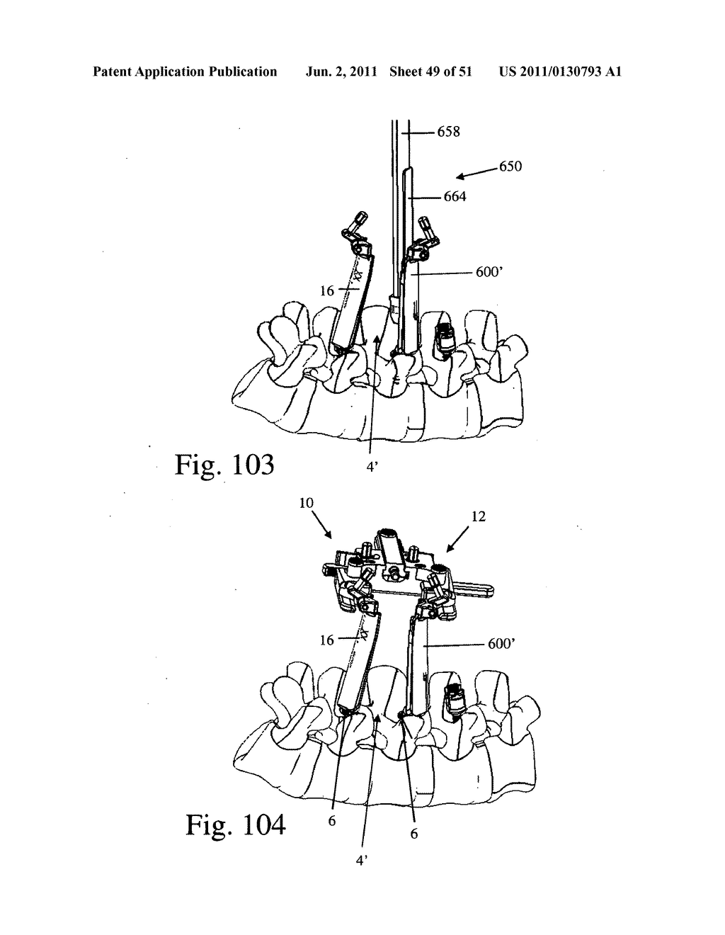 Method and apparatus for performing spinal surgery - diagram, schematic, and image 50