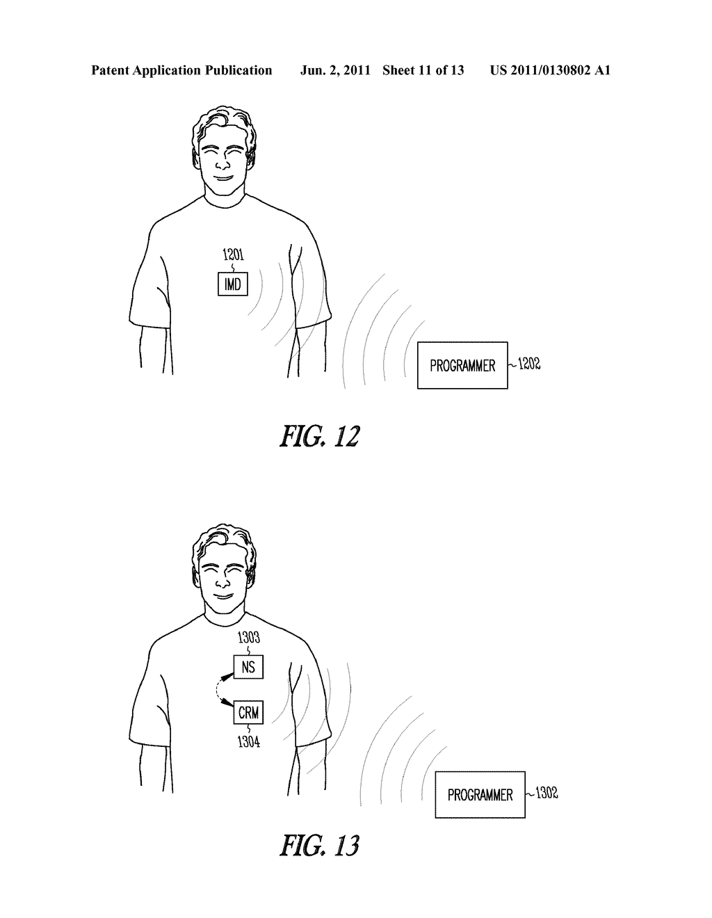 SYSTEM AND METHOD FOR TESTING NEURAL STIMULATION THRESHOLD - diagram, schematic, and image 12